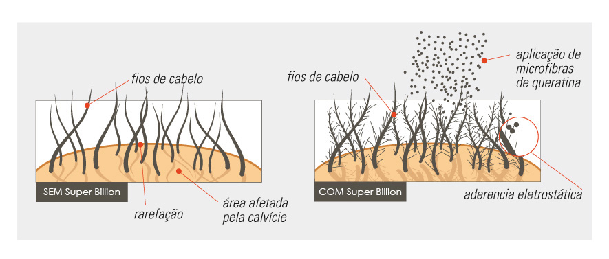 SHAMPOO CONTRA QUEDA DE CABELOS E TRATAMENTO PARA CALVÍCIE SHAMPOO CONTRA QUEDA DE CABELOS E TRATAMENTO PARA CALVÍCIE